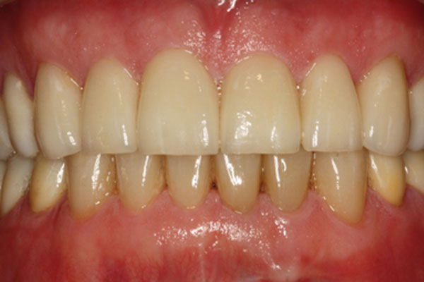 Kompleksowa terapia stomatologiczna